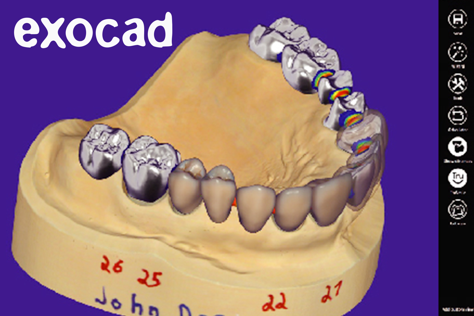 exocad